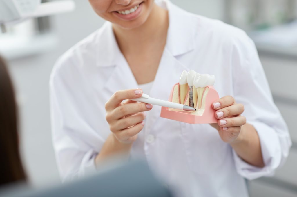 Hygienist in Nixa Explaining Tooth Implantation Process