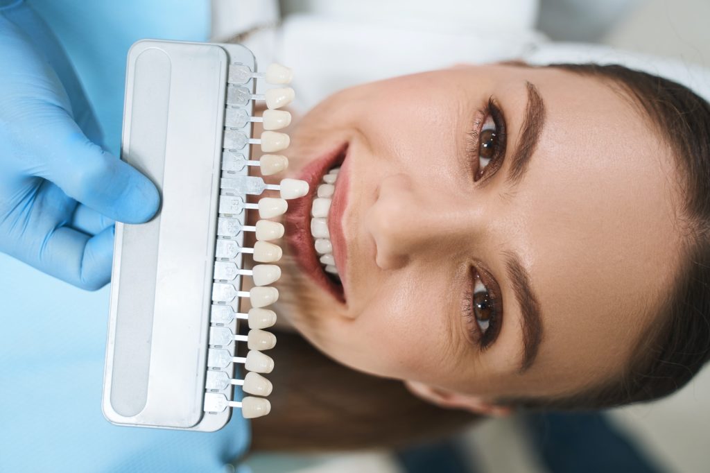 Nixa Dental patient choosing veneers